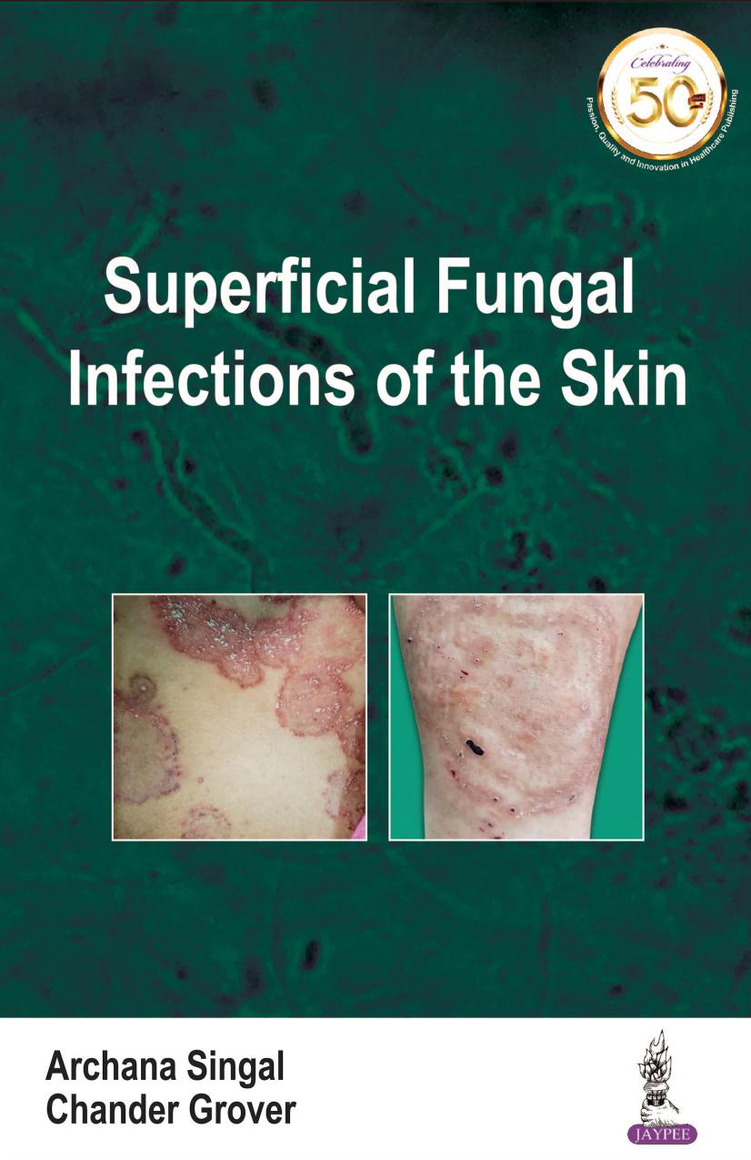 Superficial Fungal Infections of the Skin by Archana Singal; Chander Grover