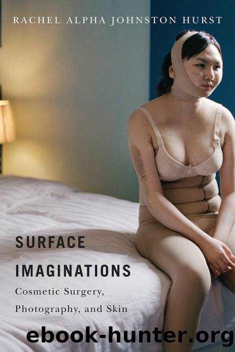 Surface Imaginations by Hurst Rachel Alpha Johnston;