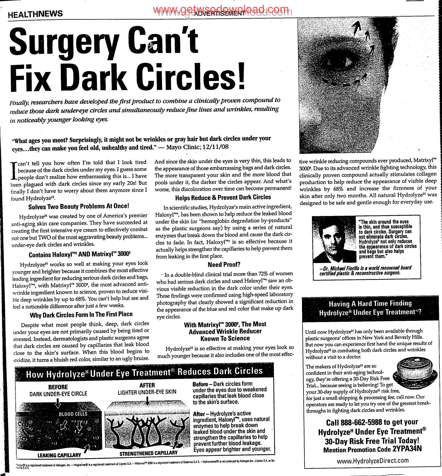Surgery Cant Fix Dark Circles 01 by Unknown