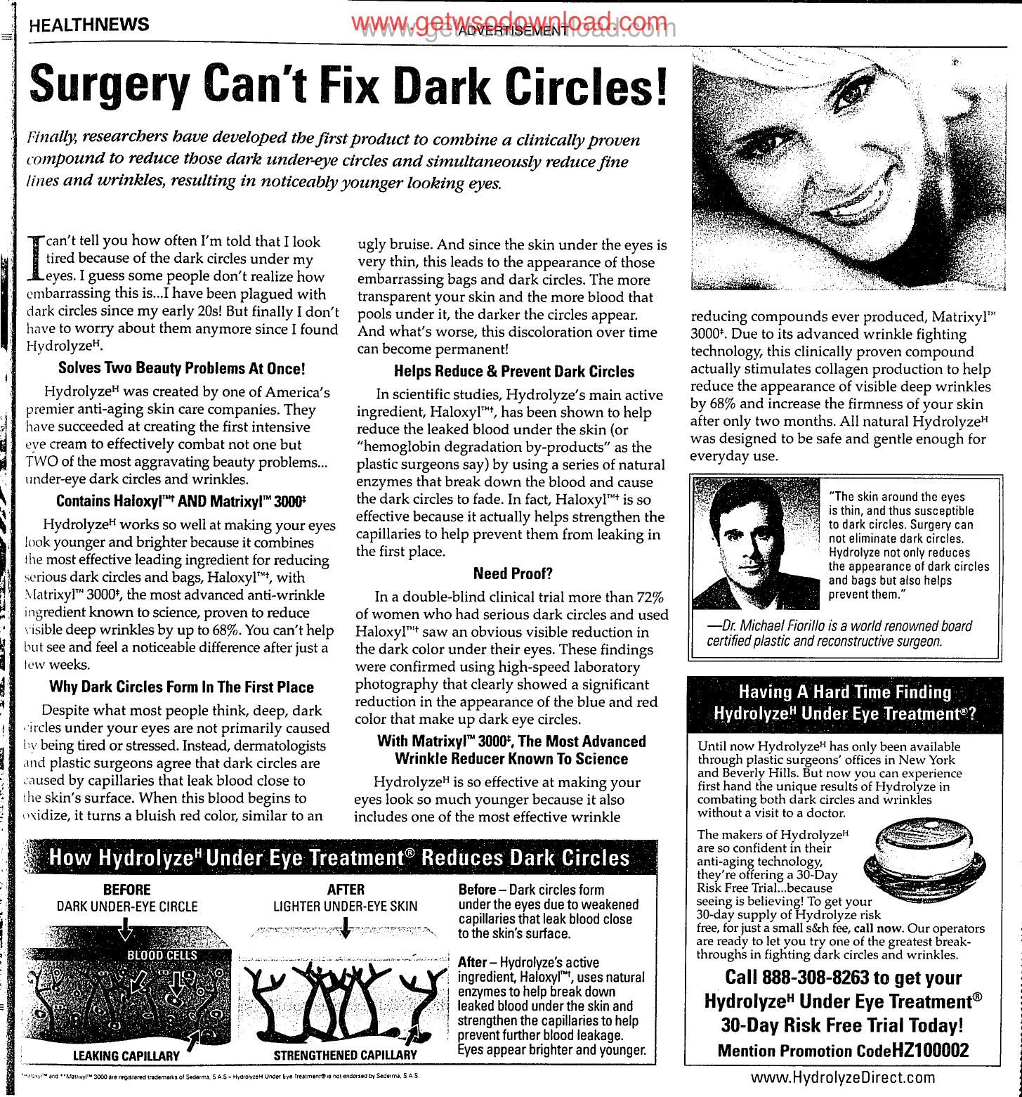 Surgery Cant Fix Dark Circles 03 by Unknown