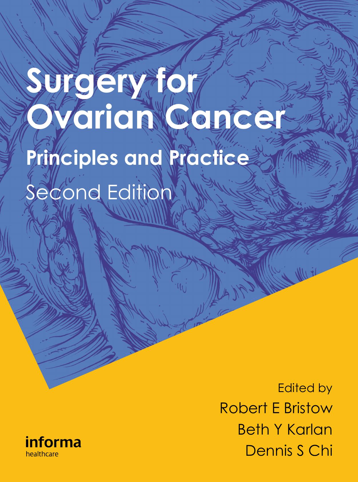 Surgery for Ovarian Cancer: Principles and Practice, Second Edition by Robert E. Bristow and Beth Y. Karlan