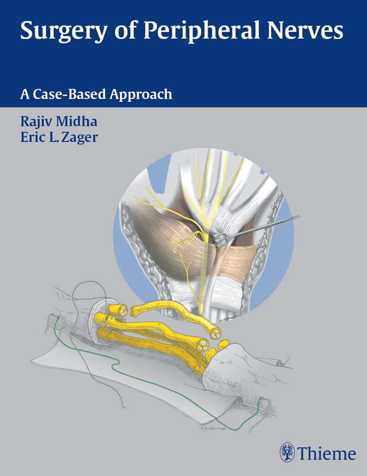 Surgery of peripheral nerves by Seletz Emil
