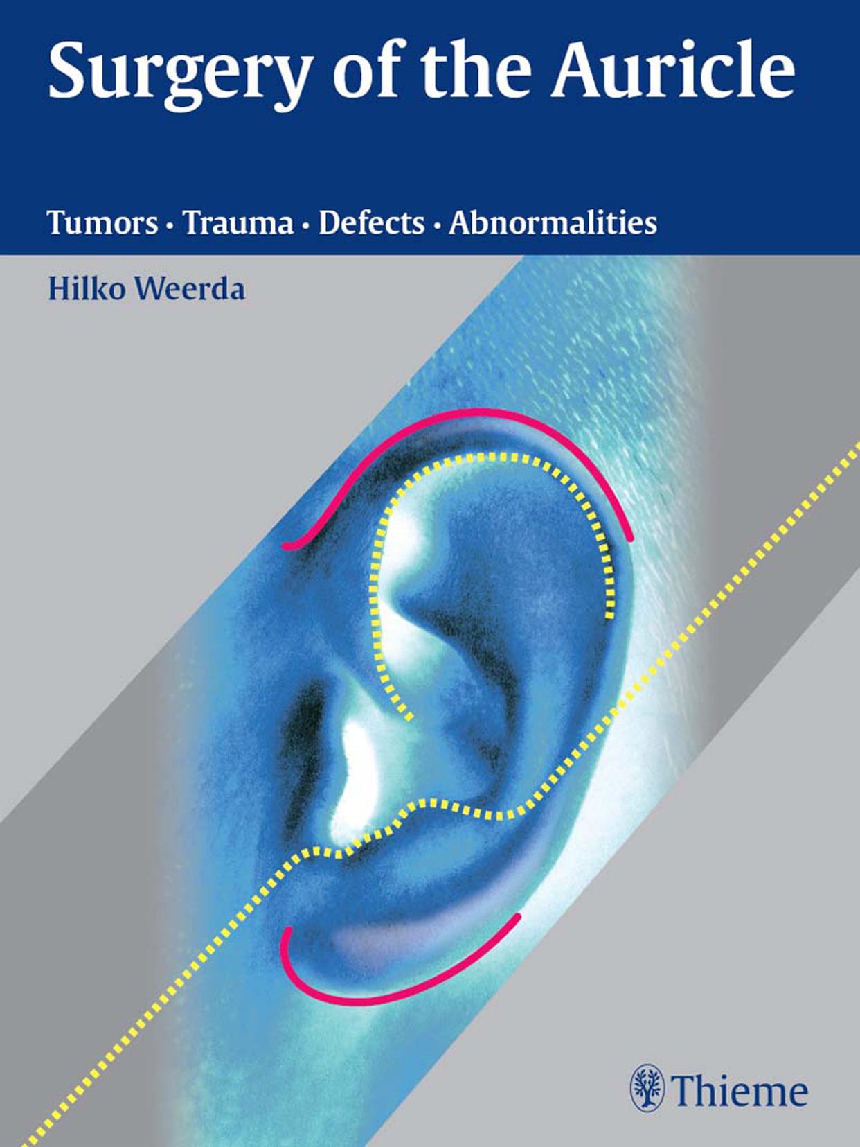 Surgery of the Auricle: Tumors-Trauma-Defects-Abnormalities by Hilko Weerda