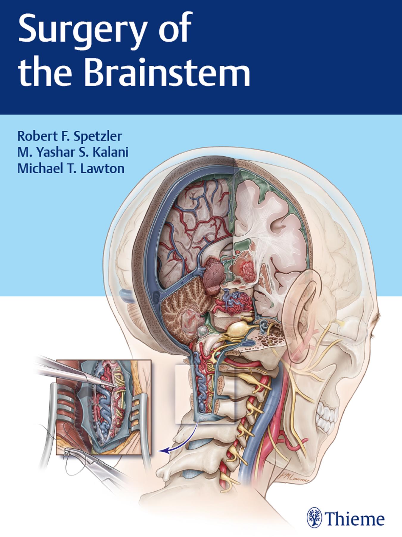 Surgery of the Brainstem by Robert F. Spetzler