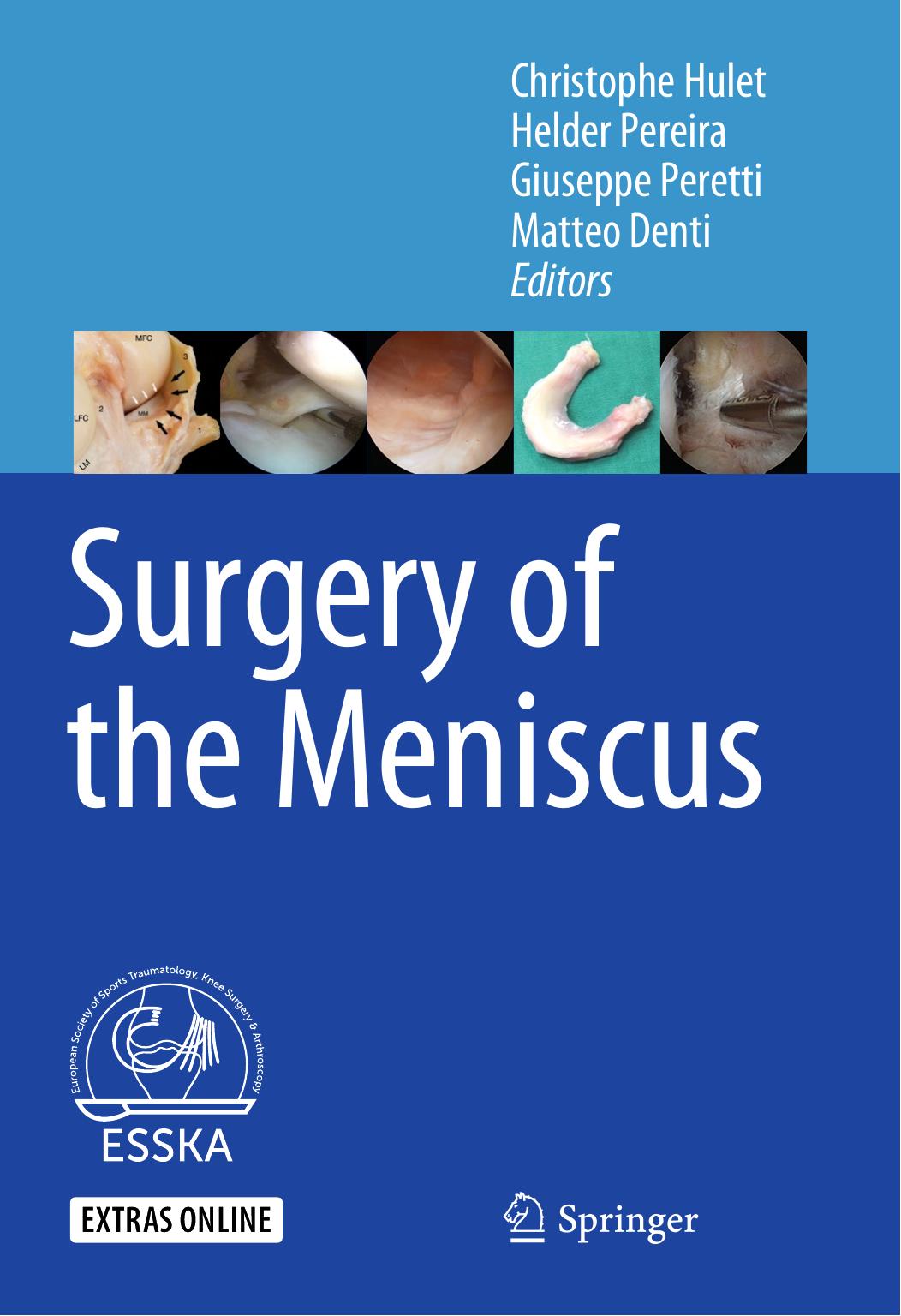 Surgery of the Meniscus by Christophe Hulet Helder Pereira Giuseppe Peretti Matteo Denti (eds.)