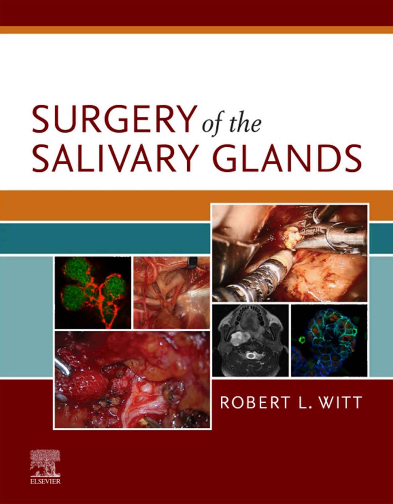 Surgery of the Salivary Glands by Robert L. Witt MD
