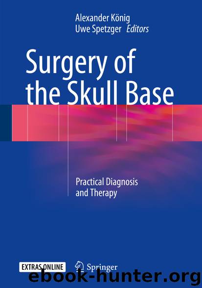 Surgery of the Skull Base by Alexander König & Uwe Spetzger