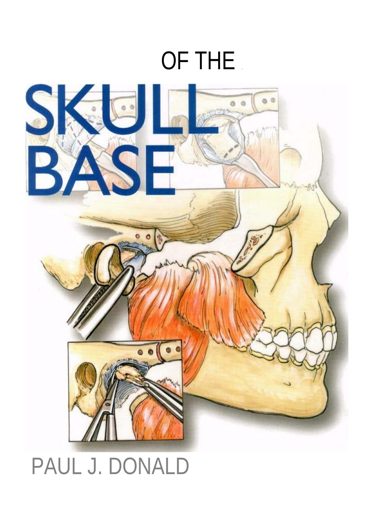 Surgery of the Skull Base by Paul J. Donald