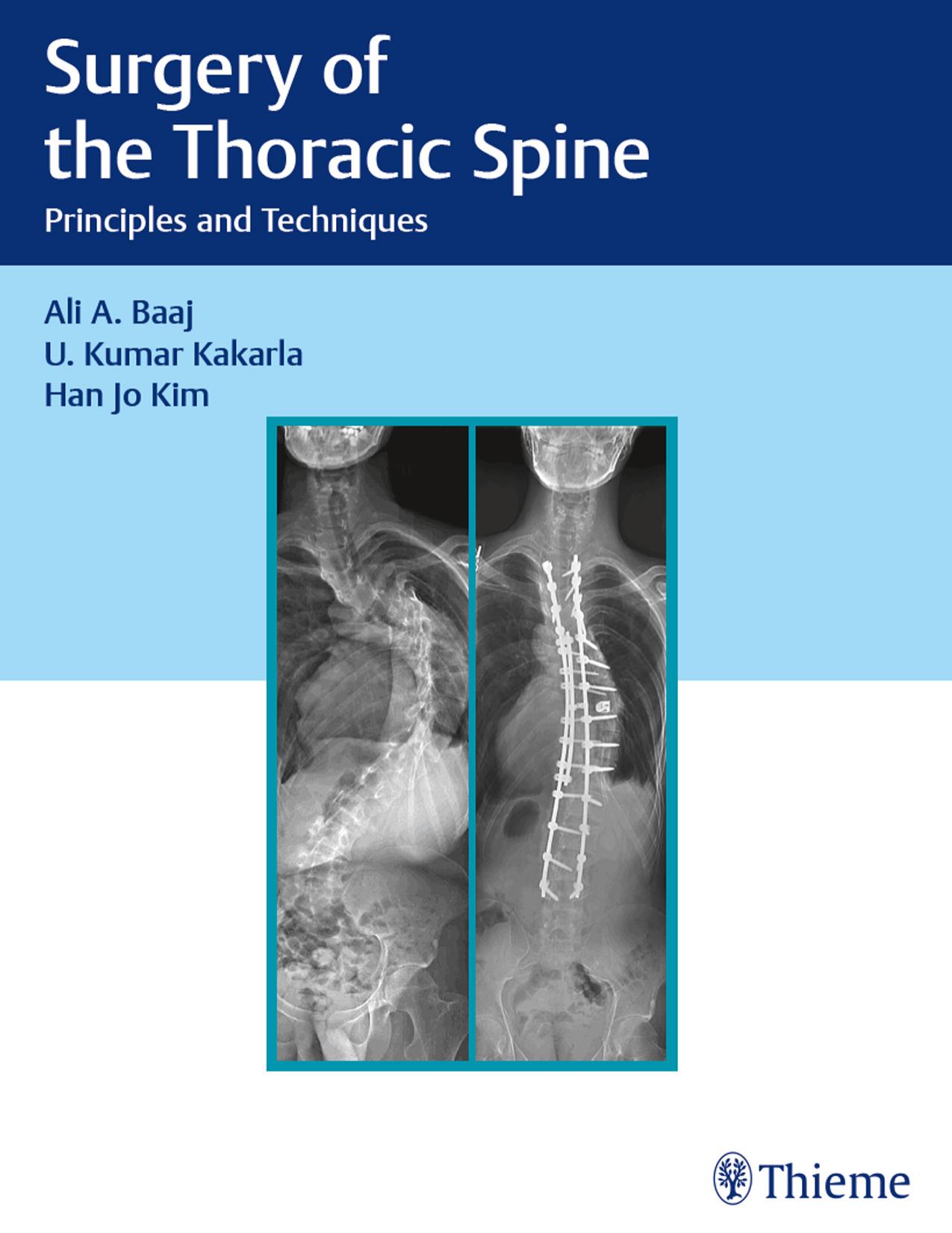 Surgery of the Thoracic Spine: Principles and Techniques by Ali A Baaj U. Kumar Kakarla Han Jo Kim