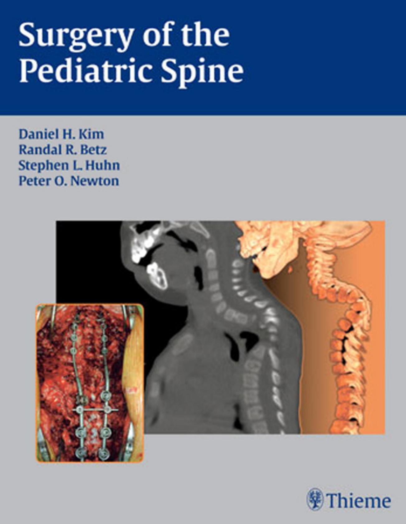 Surgery of the pediatric spine by Lawrence G Lenke Daniel H. Kim Randal R. Betz Stephen L Huhn Peter O. Newton