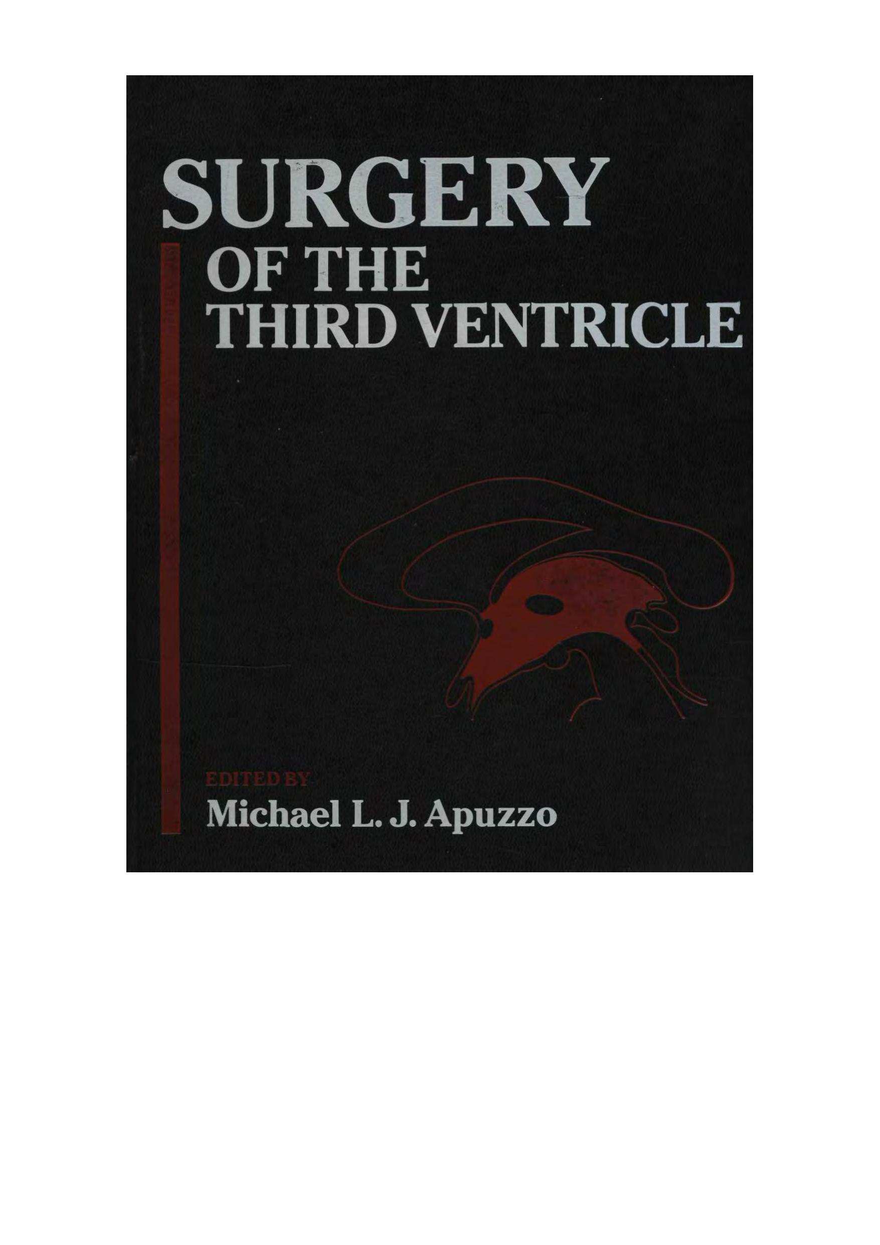 Surgery of the third ventricle by Michael L. J. Apuzzo