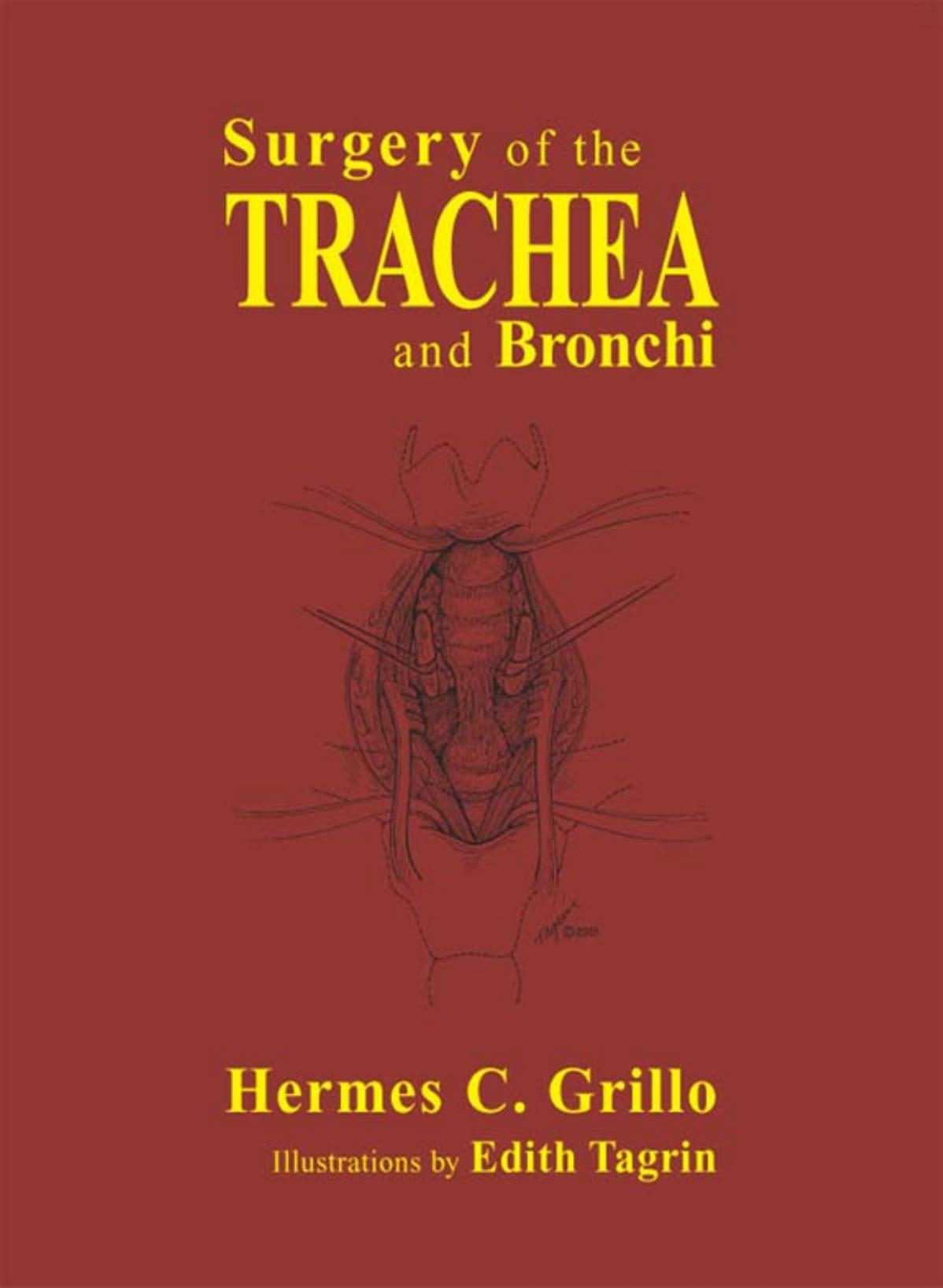 Surgery of the trachea and bronchi by Hermes C Grillo