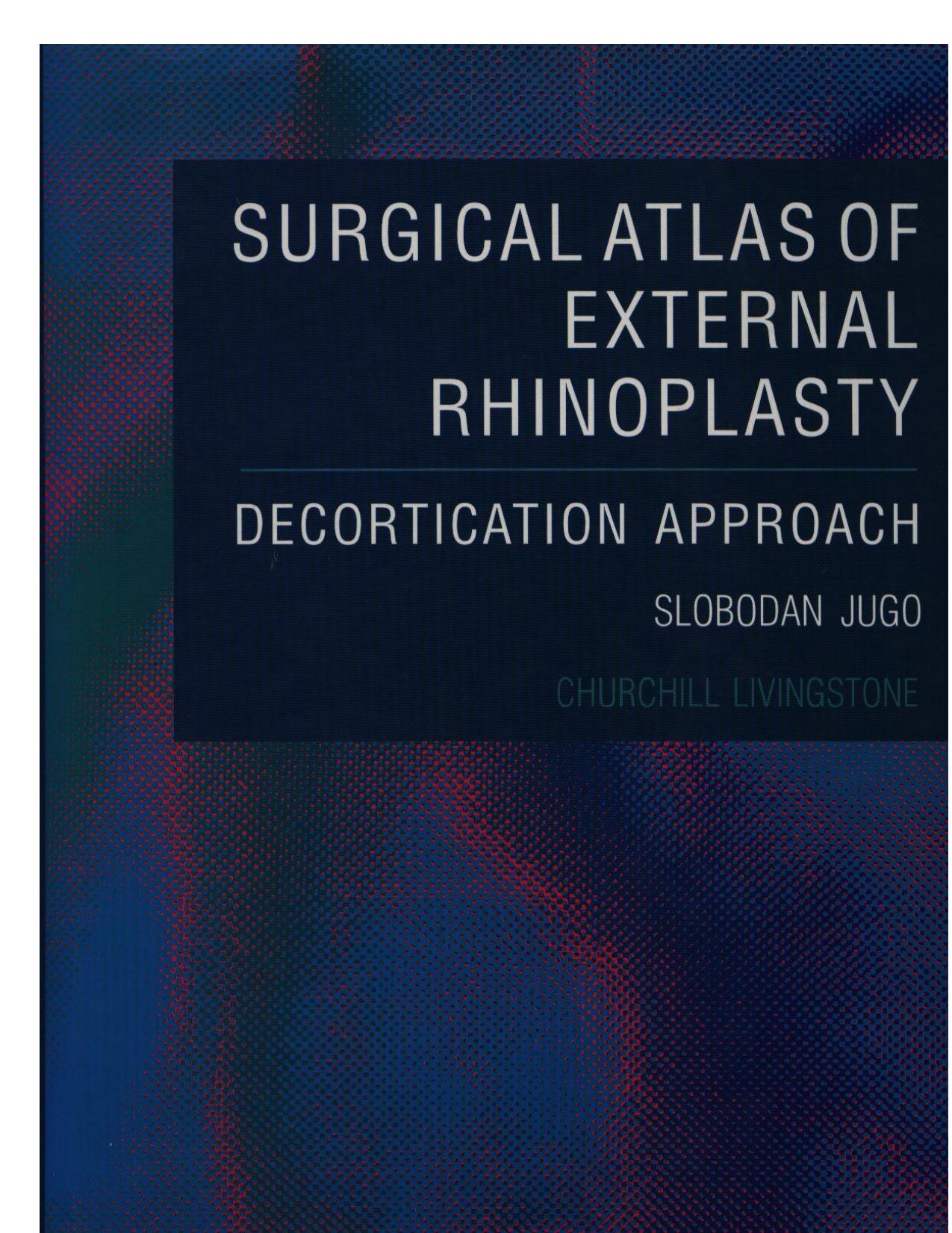 Surgical Atlas of External Rhinoplasty - Decortication Approach by zoilo