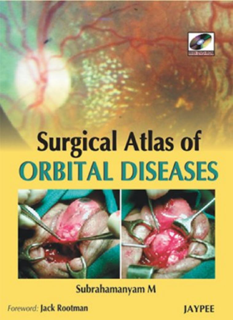 Surgical Atlas of Orbital Diseases by Unknow