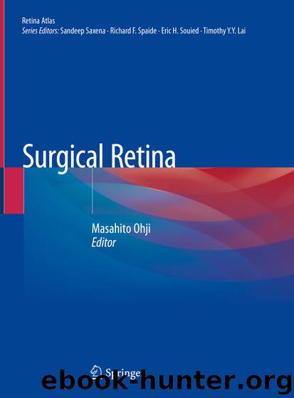 Surgical Retina by Unknown
