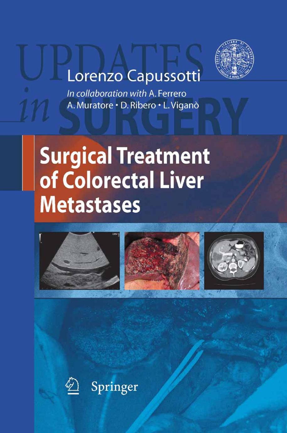 Surgical Treatment of Colorectal Liver Metastases (Updates in Surgery) by Lorenzo Capussotti