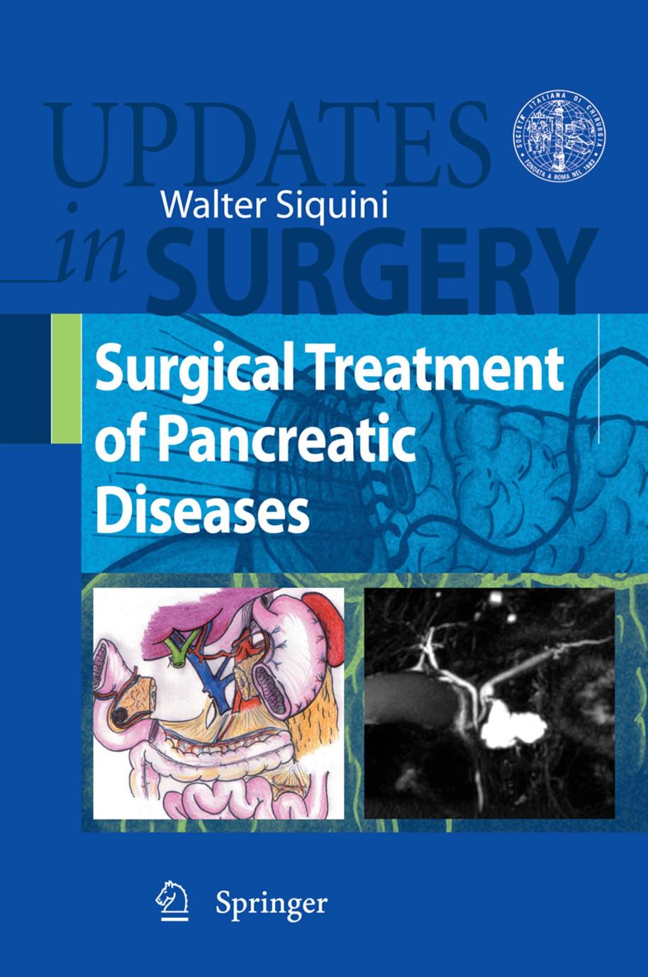 Surgical Treatment of Pancreatic Diseases (Updates in Surgery) by Walter Siquini