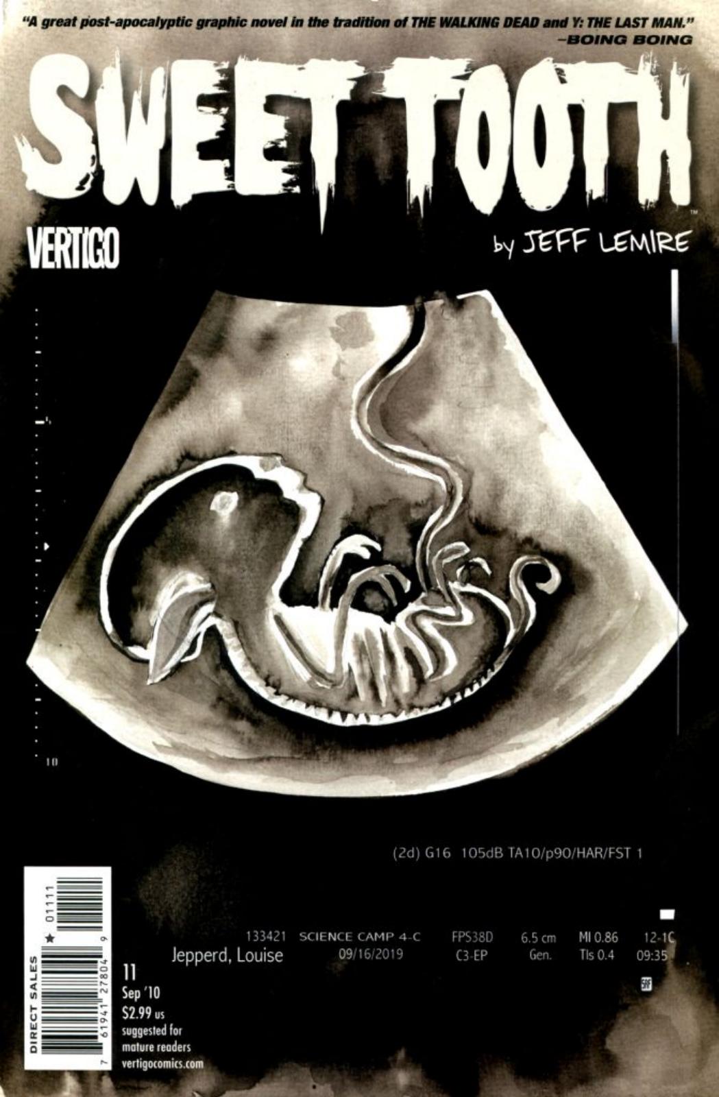 Sweet Tooth 11 by Lemire