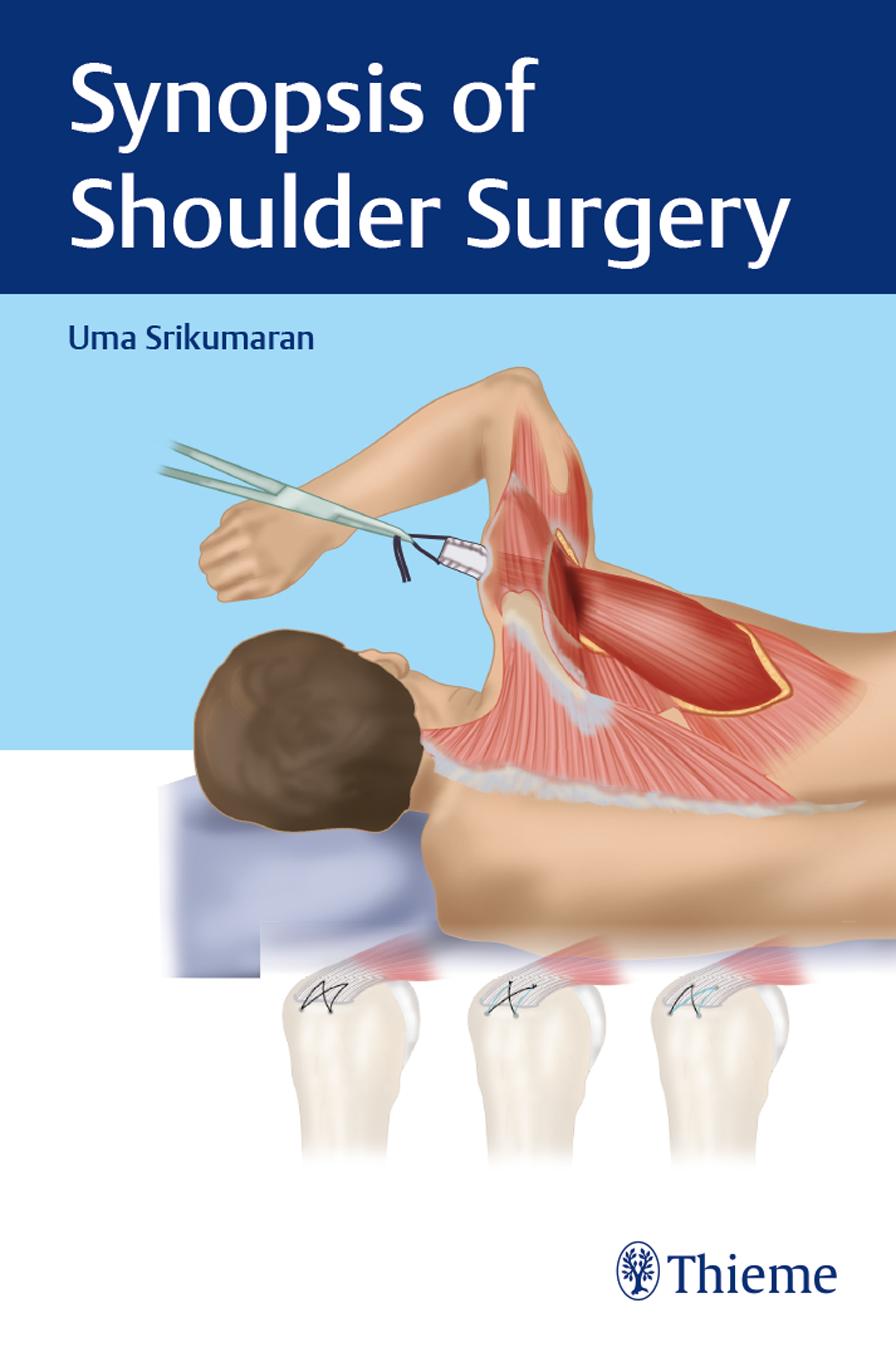 Synopsis of Shoulder Surgery by Uma Srikumaran