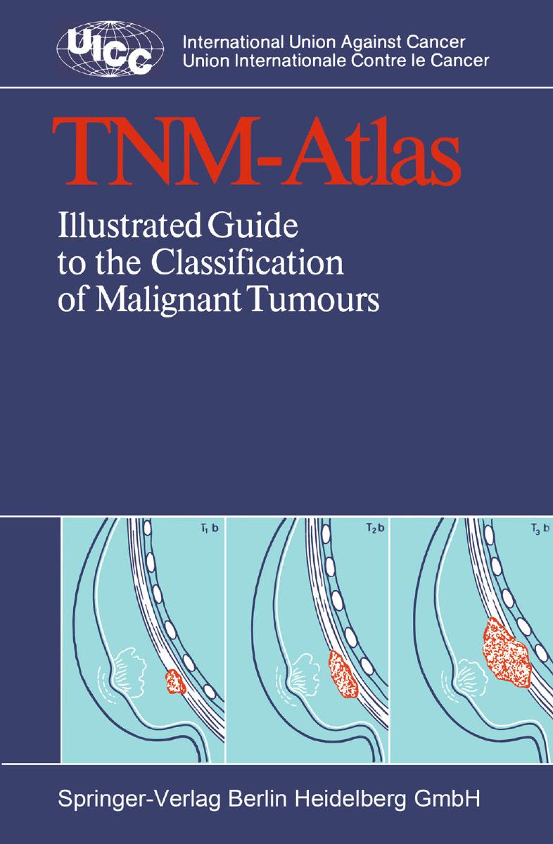 TNM-Atlas: Illustrated Guide to the Classification of Malignant Tumours by unknow