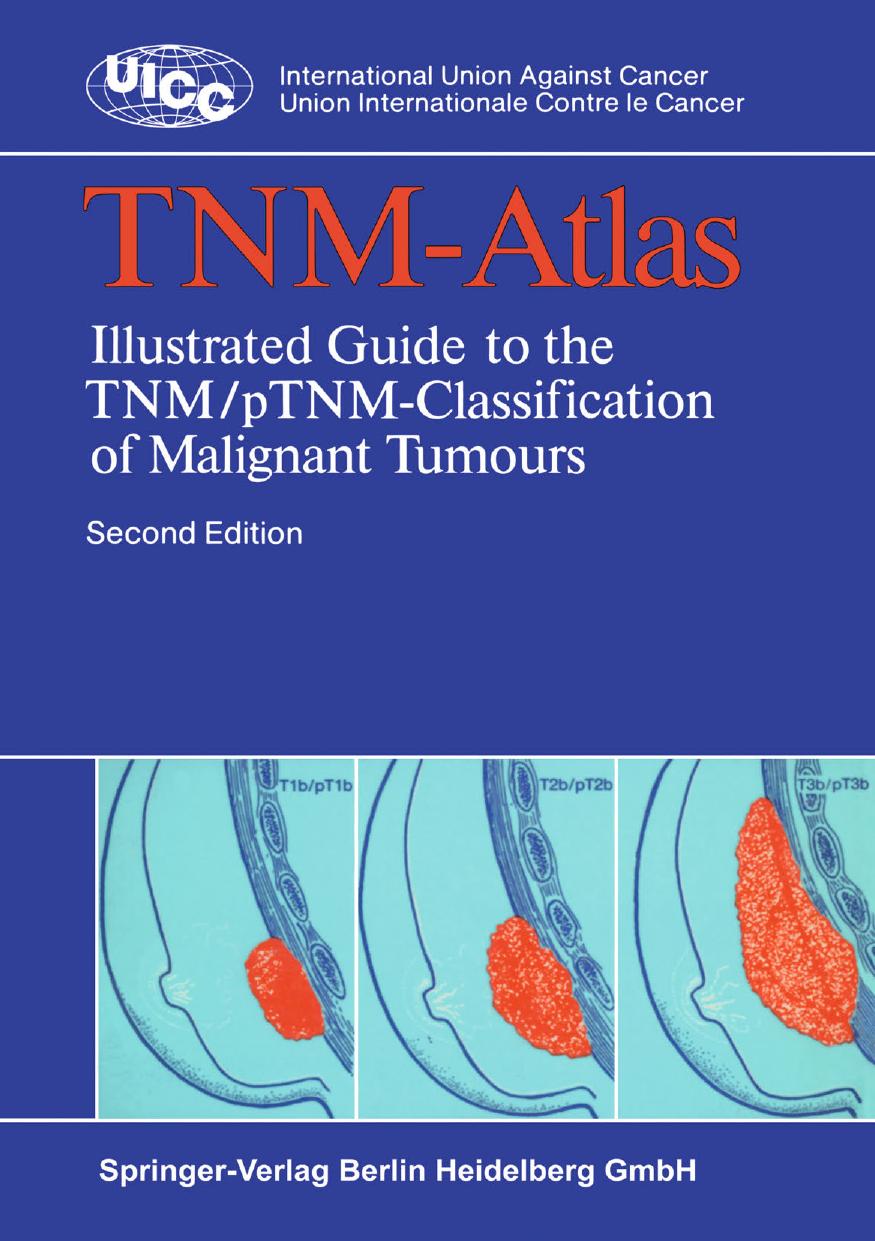 TNM-Atlas: Illustrated Guide to the TNM/pTNM-Classification of Malignant Tumours by unknow