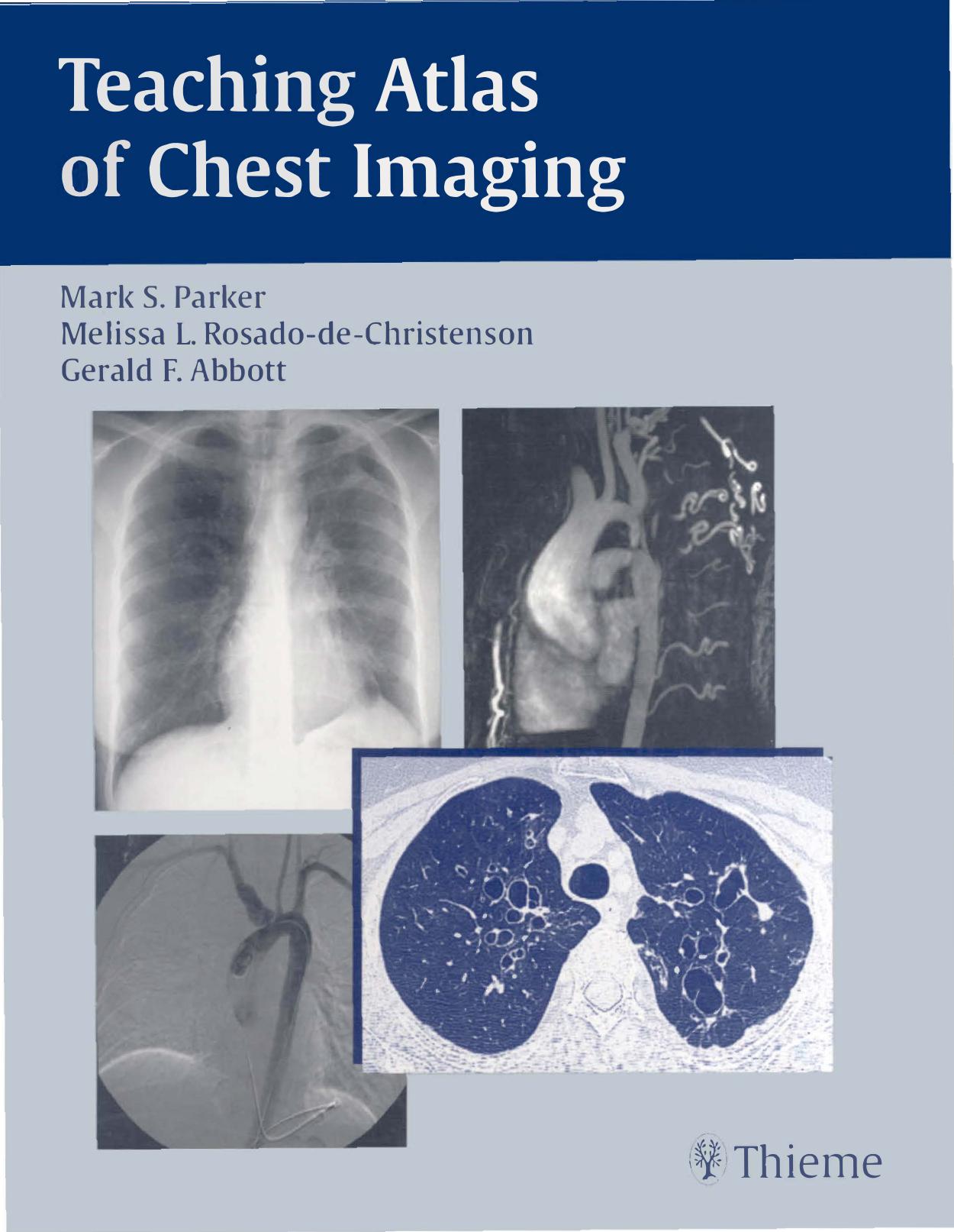 Teaching Atlas of Chest Imaging by IRAN -Persian Gulf - Small Tounb Island