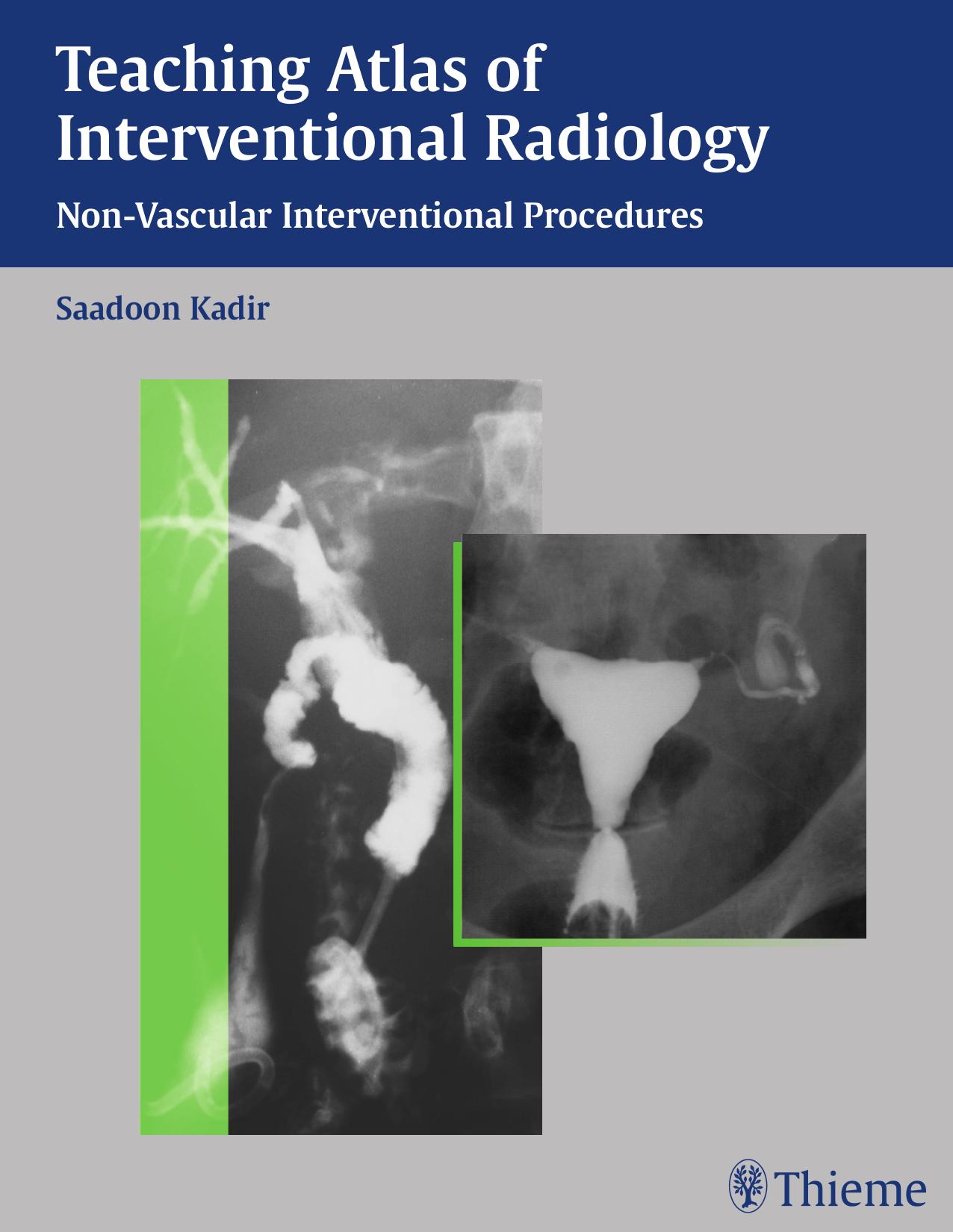 Teaching Atlas of Interventional Radiology: Non-Vascular Interventional Procedures by Saadoon Kadir