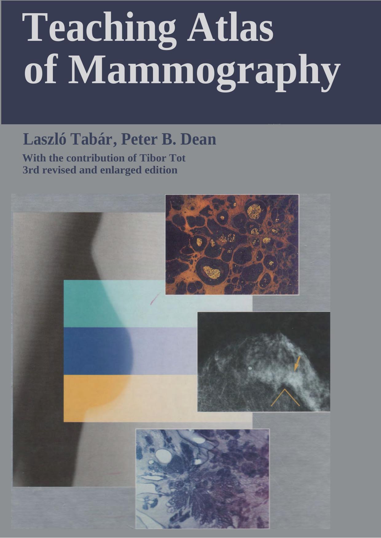Teaching Atlas of Mammography by L. Tabar P. Dean (Thieme 2001) WW