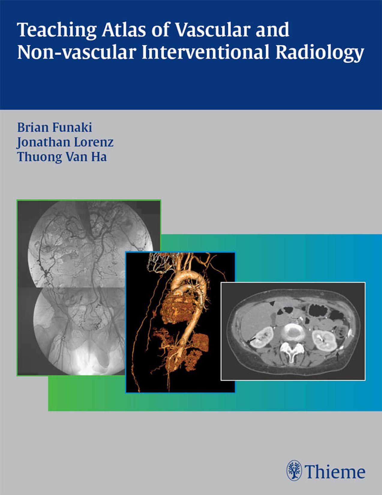 Teaching Atlas of Vascular and Non-vascular Interventional Radiology by Brian Funaki