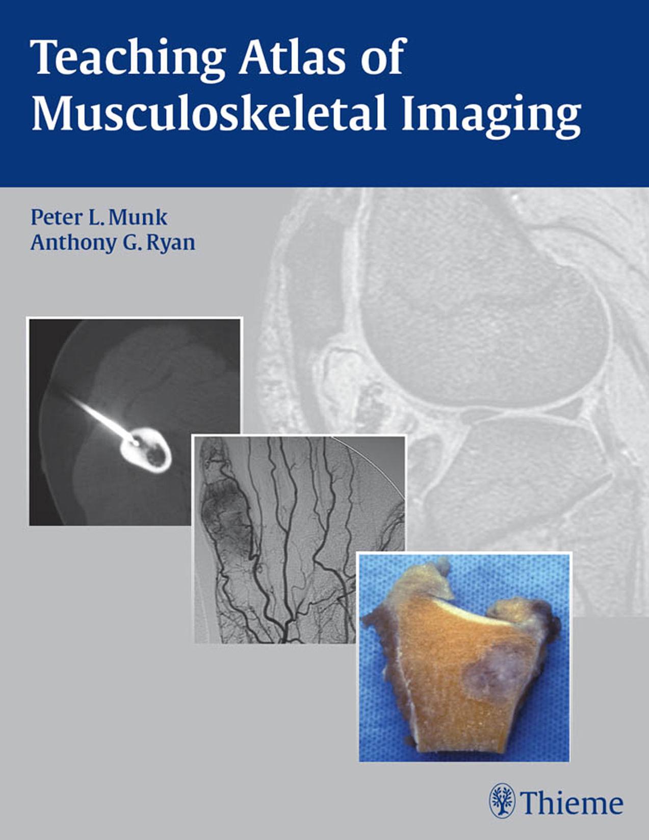 Teaching atlas of musculoskeletal imaging by Peter L. Munk Anthony G. Ryan