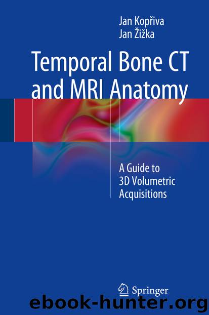 Temporal Bone CT and MRI Anatomy by Jan Kopřiva & Jan Žižka