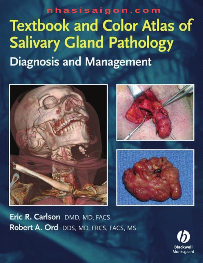 Textbook and Color Atlas of Salivary Gland Pathology Diagnosis and Management by Eric R. Carlson