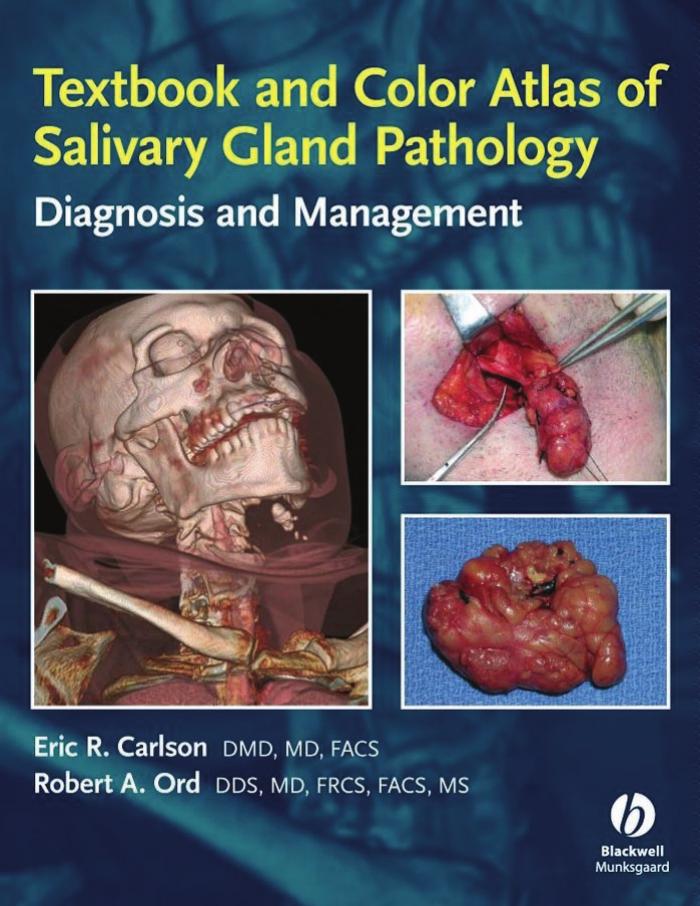 Textbook and Color Atlas of Salivary Gland Pathology by Unknow