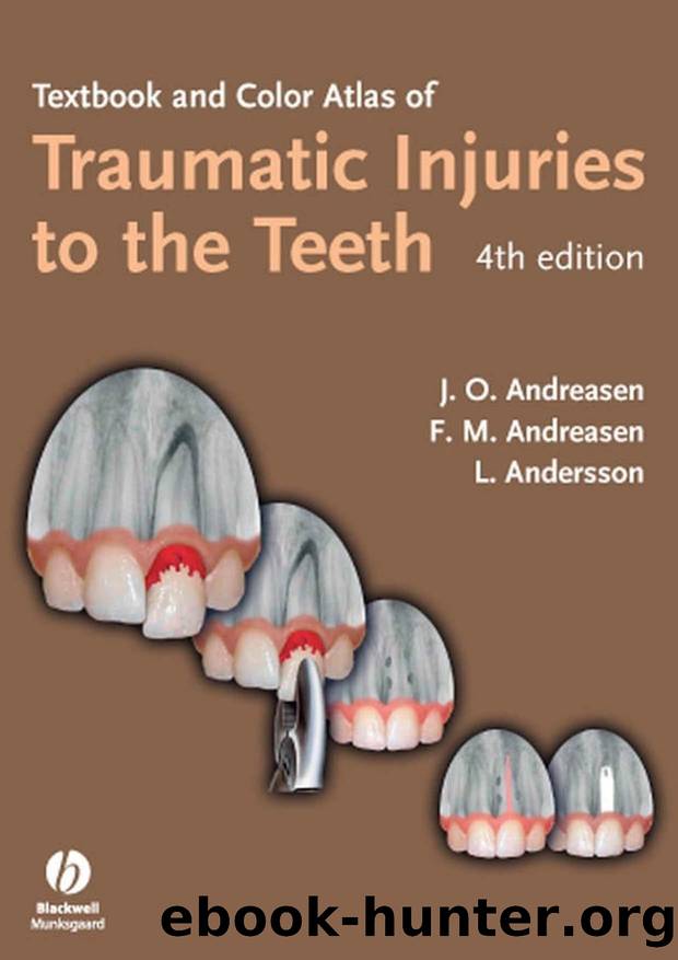 Textbook and Color Atlas of Traumatic Injuries to the Teeth by Unknown