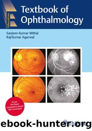 Textbook of Ophthalmology by Sanjeev Kumar Mittal & Raj Kumar Agarwal