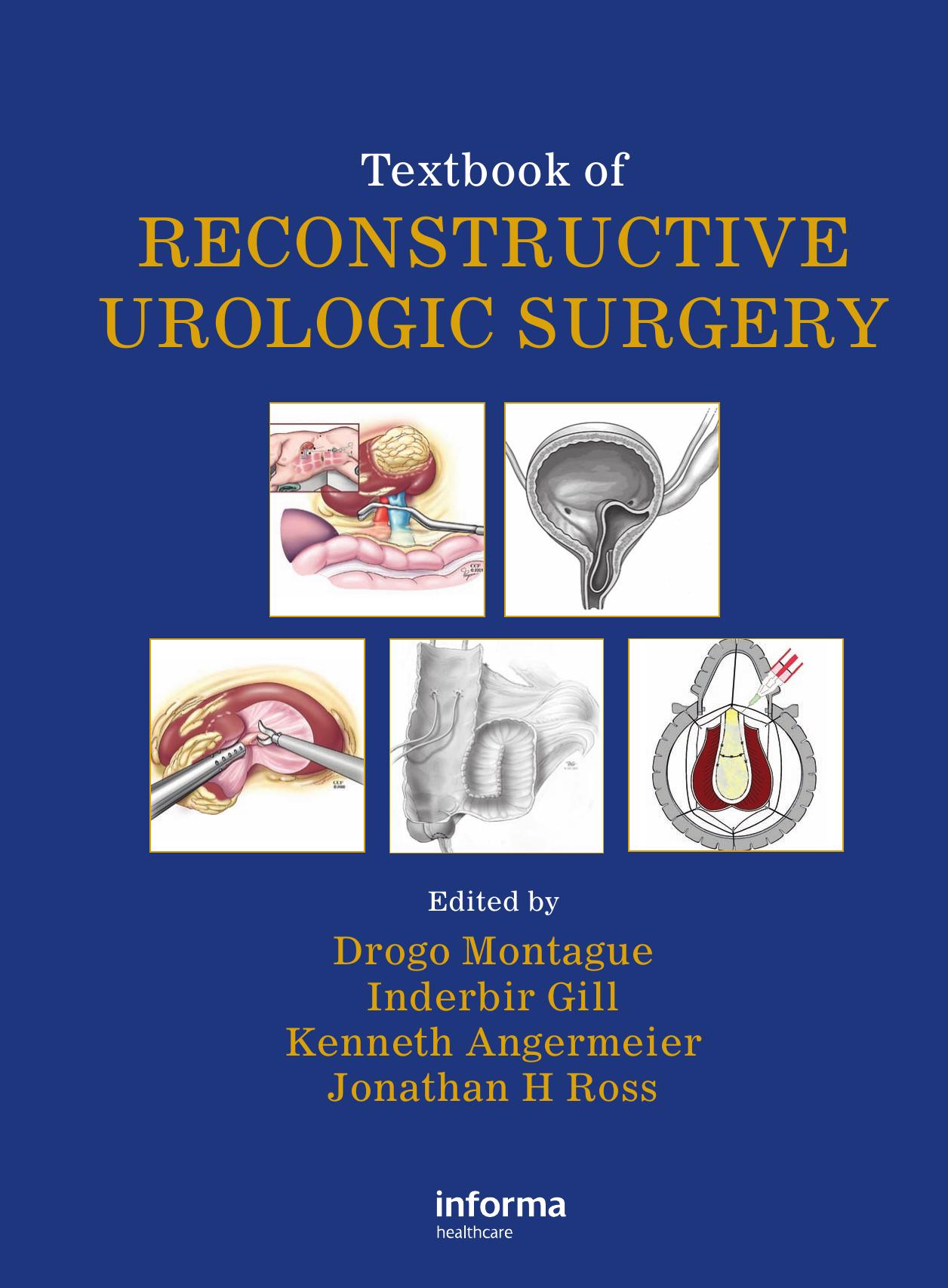 Textbook of Reconstructive Urologic Surgery by Montague Graham