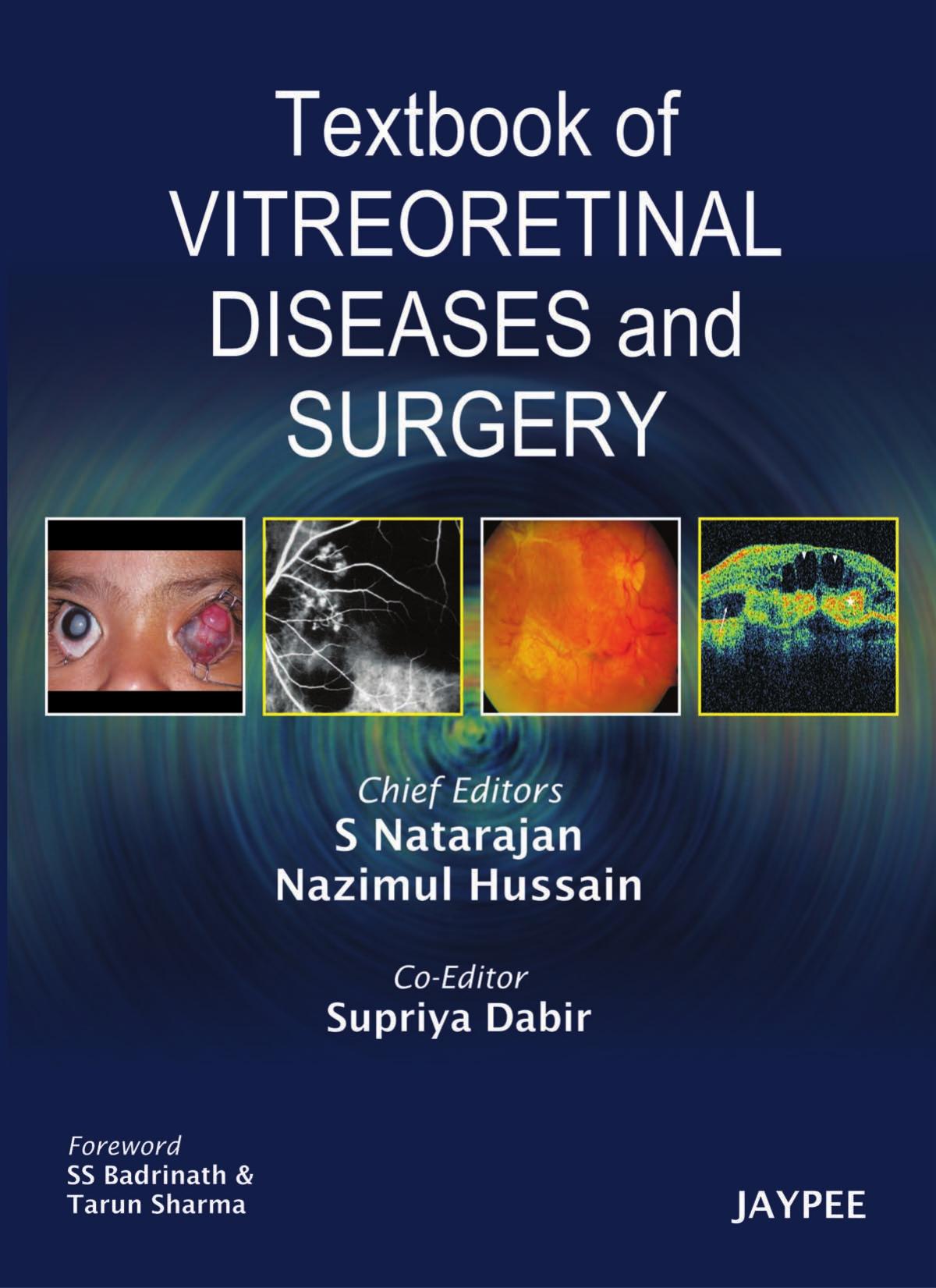 Textbook of Vitreoretinal Diseases and Surgery by S Natarajan Nazimul Hussain