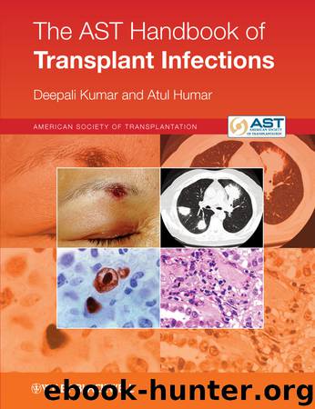 The AST Handbook of Transplant Infections by Kumar Deepali; Humar Atul; & Atul Humar