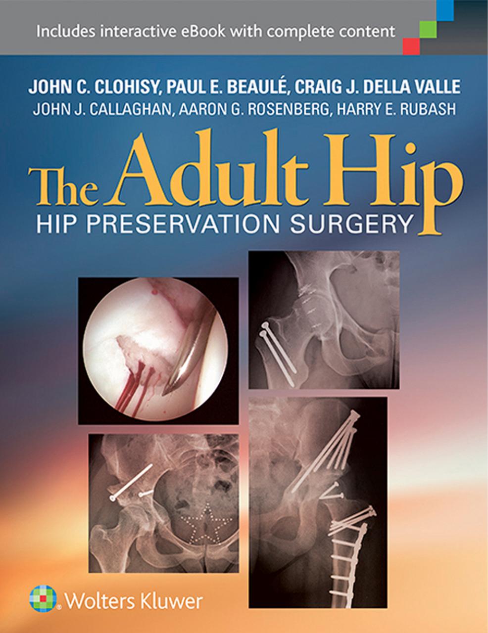 The Adult Hip: Hip Preservation Surgery by unknow