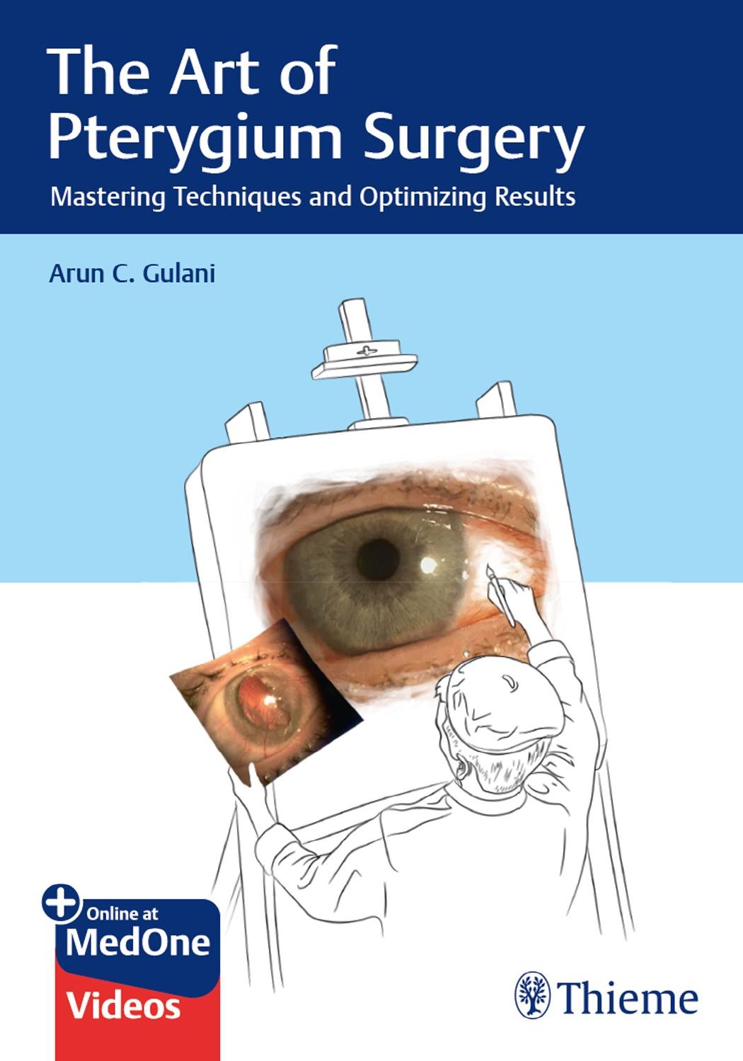 The Art of Pterygium Surgery: Mastering Techniques and Optimizing Results by Unknow