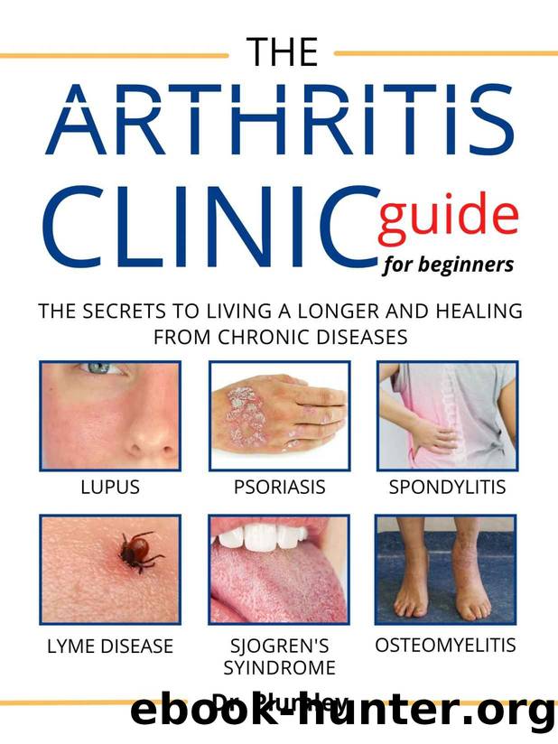 The Arthritis Clinic Guide for Beginners by PLUMLEY DR