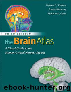 The Brain Atlas by Thomas A. Woolsey & Joseph Hanaway & Mokhtar H. Gada