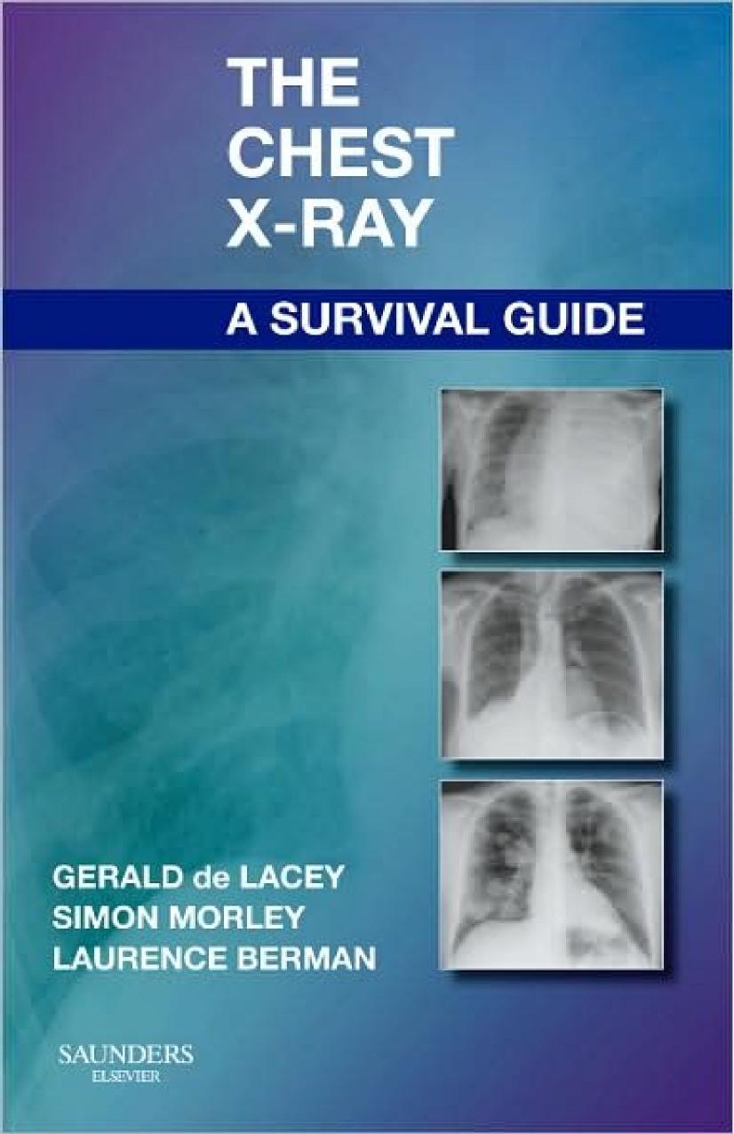 The Chest X-Ray: A Survival Guide by Gerald de Lacey Simon Morley Laurence Berman