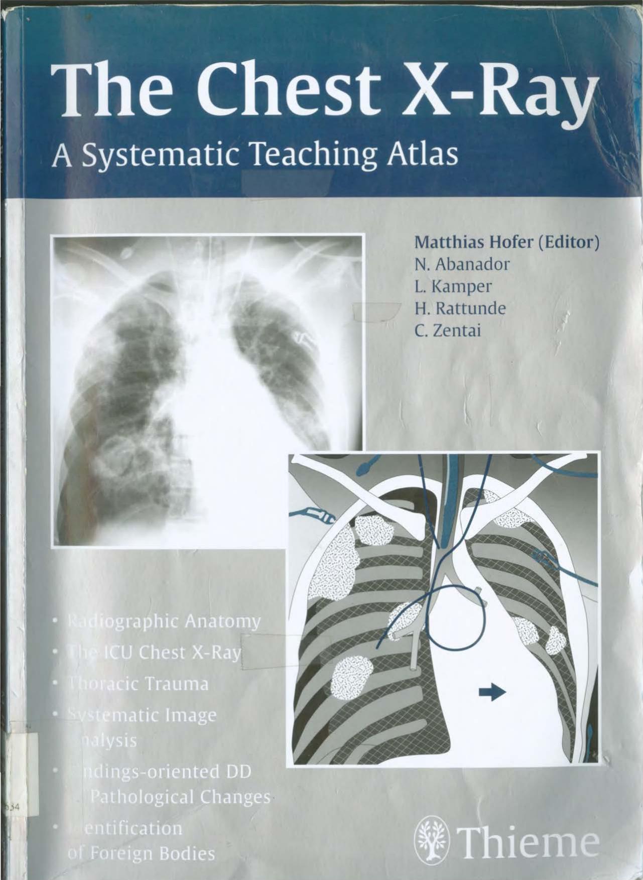 The Chest X-Ray-The Systematic Teaching Atlas. by Matthias Hofer (ed.)