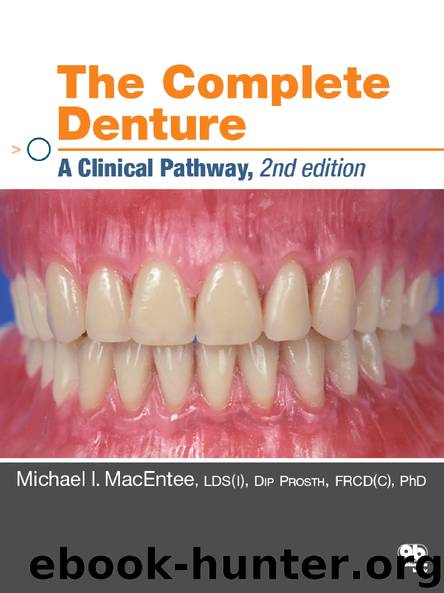 The Complete Denture: A Clinical Pathway by MacEntee