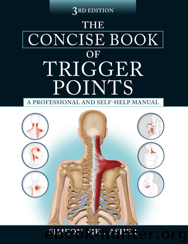 The Concise Book of Trigger Points by Simeon Niel-Asher