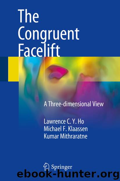 The Congruent Facelift by Lawrence C. Y. Ho Michael F. Klaassen & Kumar Mithraratne