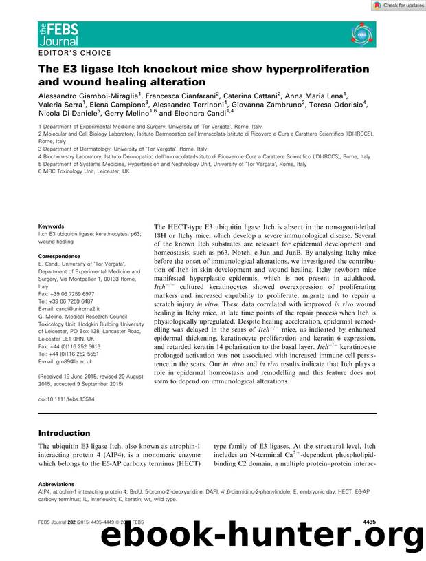 The E3 ligase Itch knockout mice show hyperproliferation and wound healing alteration by Unknown