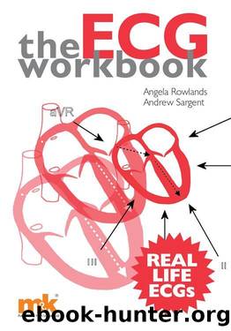 The ECG Workbook by Angela Rowlands & Andrew Sargent