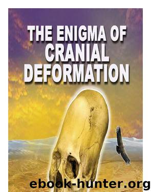 The Enigma of Cranial Deformation by David Hatcher Childress
